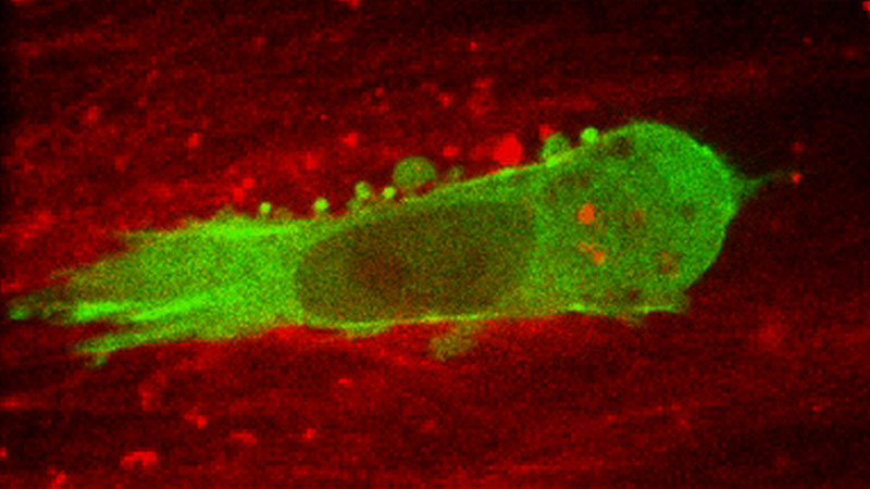 A confocal microscope image of a migrating human fibroblast in its 3D extracellular matrix