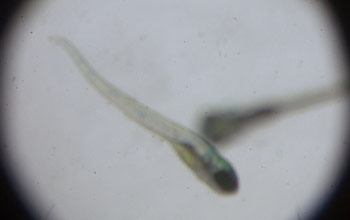 A juvenile zebrafish swims under the microscope—the Puertollano group uses zebrafish to understand lysosomal disease